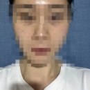 일상속에 행복했던 순간들(대구땡큐네일, 피코슈어토닝, 줌패스후기, 홈가든, 방토 상추키우기)