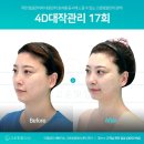 고운얼굴 | 스마트폰 중독 봉선동 고운빛깔 에스테틱에서 체형 교정 겸 얼굴 라인 정리하고 온 후기