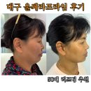 프라임요양병원 | 대구 성형외과 50대 리프팅 추천 울쎄라 프라임 내돈내산