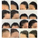 수헤어라인 이미지