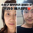 수성3로 | 수성구 피부관리 잘하는 온리수 에스테틱 수성동 팔자주름 효과본 후기