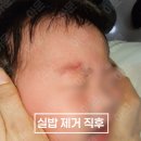 아기눈썹