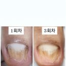 케이큐어 이미지