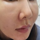 얼굴만들기 - 광양시 | 올리디아 콜라겐부스터 청담피부과 동안얼굴 만들기 솔직후기