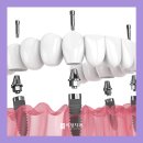 허정치과의원 이미지