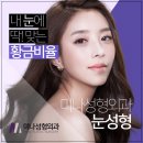 미나성형외과 네이버블로그