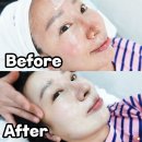 부산 서면 피부관리 블랑미에서 물광 스킨플래닝 받아 본 후기