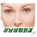 비골골절로 인한 휜 코뼈 성형 이미지