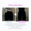 예지패키지