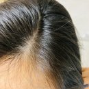 테라피플러스 이미지