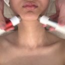 스킨뮤제 : 울산 피부관리 / 남구청 에스테틱 / 물방울리프팅만족후기