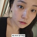 페니터치 회기역점 | [비포애프터] 페니터치 회기에스테틱에서 레이저토닝 받았어요! (피부관리 추천 / 예약방법)