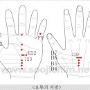 수지침 이미지