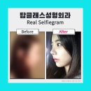 탑성형외과의원 이미지