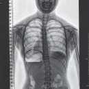 참좋은보조기 이미지