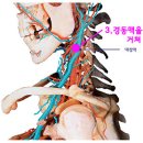 수승 화강 - 뇌 압 낮추기와 치매 예방 1분의 장수 운동 비법 이미지