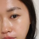 인셀덤 아카데미,인셀덤 크림 7일 사용후기