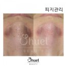 피지메디칼