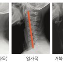 빛의전신