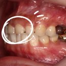 세련치과기공소 이미지