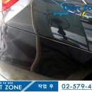 덴트존 이미지