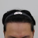 맘모스헤어라인의원