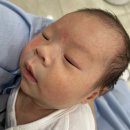 수영어린이병원 | 27일차 신생아 설소대 시술 후기 수영 어린이병원