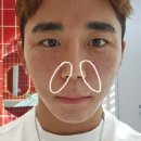 힐로