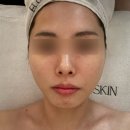 둔산중로-38 | 둔산동피부관리 플로럴스킨 둔산점 윤곽케어 후기