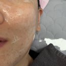 대정동물병원 | 서귀포에스테틱 에이엔에이룸 여드름 트러블케어 관리 후기