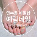 예림네일아트 | 예림네일 동춘동 네일샵 파우더네일 여름맞이 페디큐어 후기