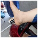 비고르바른건강핫톡 | 발마사지 비고르바른건강 구미점 고주파 발체온기 무료체험 가능한 곳