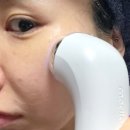유세라 | 피부 탄력 개선 / 홈 디바이스 추천/유세라딥샷 1세대