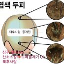두피탈모태후사랑 이미지