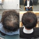 블랭크smp 이미지