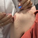 안아픈경희한의원 | 화곡동 한의원 봉침 치료 통증 개선 내돈내산 후기