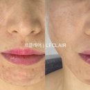 쏭클레어 네이버블로그