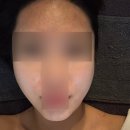 김시안에스테틱 | 강남바디관리 LPG 김시안 에스테틱 엔더몰로지 페이스 윤곽 관리