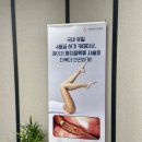 하지정맥류 원인과 예방방법 부산하지정맥류