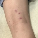 광양한의원 이미지