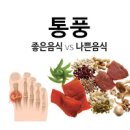 통풍에 안좋은 음식 알아야 예방도 할 수 있어 이미지