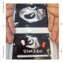 봉담주민건강지원센터 | 임신8주 초음파 / 화성시보건소 산전검사 예약 / 화성시기형아검사 비용지원
