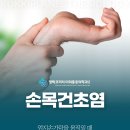 손목건초염 증상, 엄지손가락 움직일 때 찌릿한 통증 자가진단법