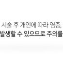 국원석성형외과의원 네이버블로그