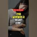 간이 살려달라고 보내는 신호 - 간 건강에 좋은 음식 이미지