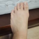 황산내과의원 | 대전 서울굿내과 의원 무좀 탈모 비만 전문 후기