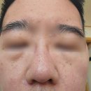 Feel뷰티 | 뷰티디바이스 큐리케어 펄즈 물방울초음파로 속건조 탄력 잡은 솔직 후기, 앰플 꿀팁까지