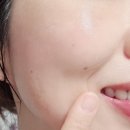 진피오니 이미지