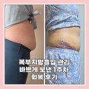 엄마손 손세탁 송천점 | 복부지방흡입 관리 바쁘게 보낸 1주차 회복 후기