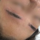 더라인스틸 | 수원역 눈썹 반영구 잔흔제거 고민이라면? [스틸픽스]내돈내산 추천 후기